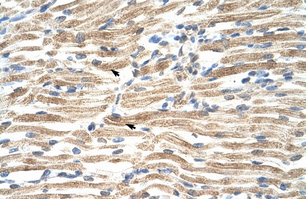 YAF2 antibody