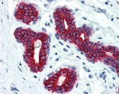 Keratin Antibody