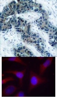 IkB a (phospho Ser32 / Ser36) Antibody