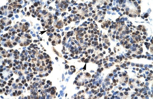 HOXB5 antibody
