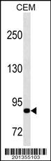 MMP9 Antibody