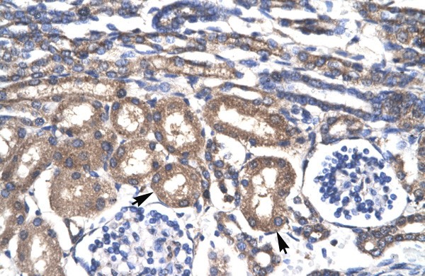 KLF8 antibody - N-terminal region