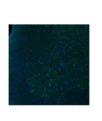 HTR2B antibody