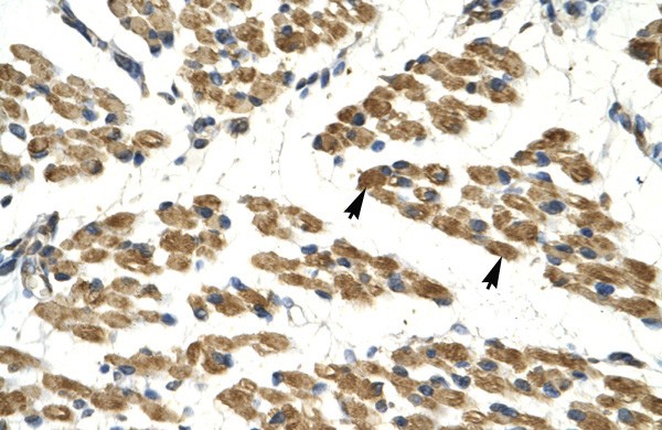 HHEX antibody