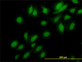 NEK3 Antibody (monoclonal) (M01)