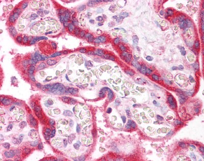 IRAK Antibody