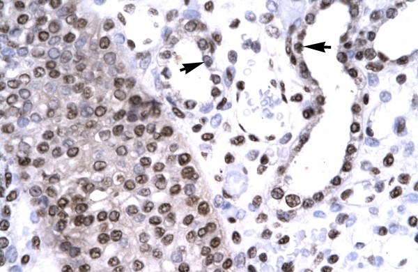 BARHL2 antibody - middle region