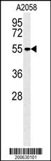 MMP14 Antibody (C-term)