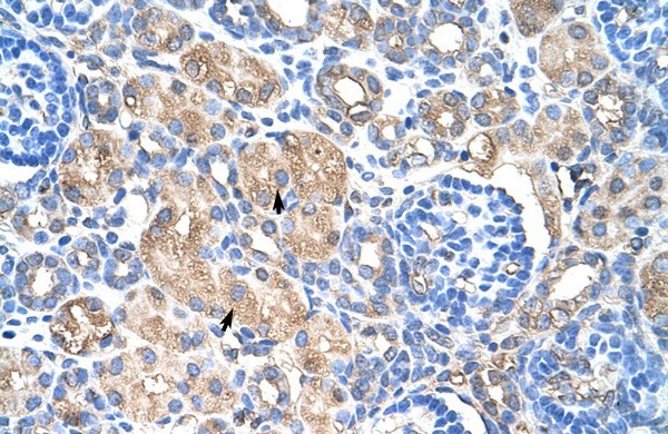 HSPB1 antibody