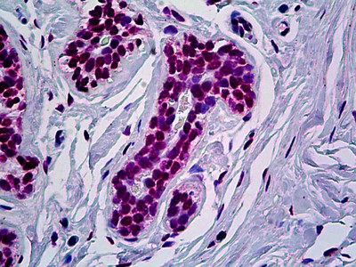 RUNX1 Antibody