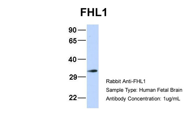 FHL1antibody - N-terminal region