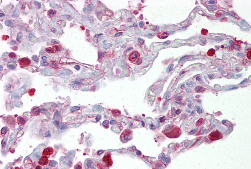 FOSL1 antibody