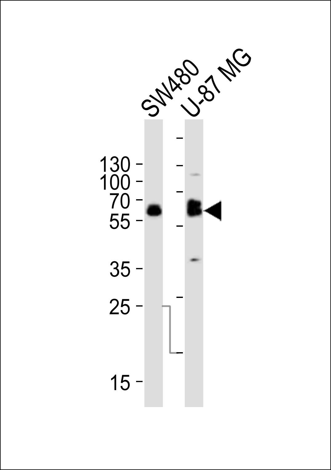 TH Antibody