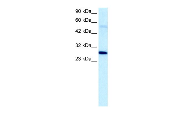 PARP1antibody - C-terminal region