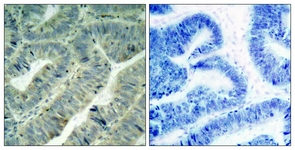 Src (Phospho-Tyr418) antibody