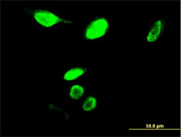 MYBL2 Antibody (monoclonal) (M03)