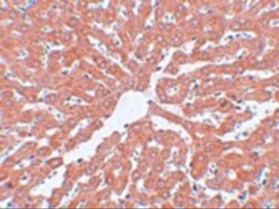 IRAK Antibody
