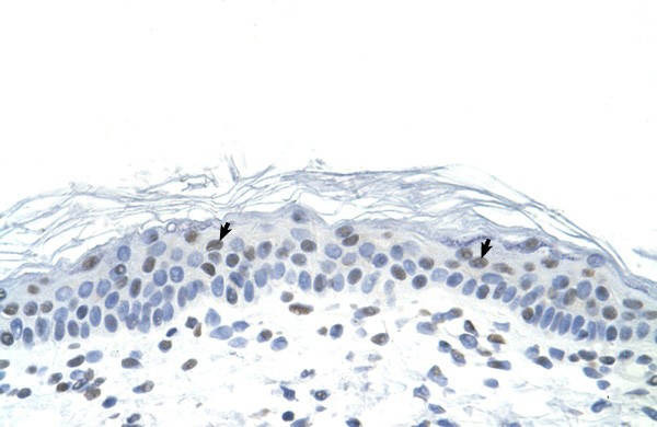 FOSL1 antibody