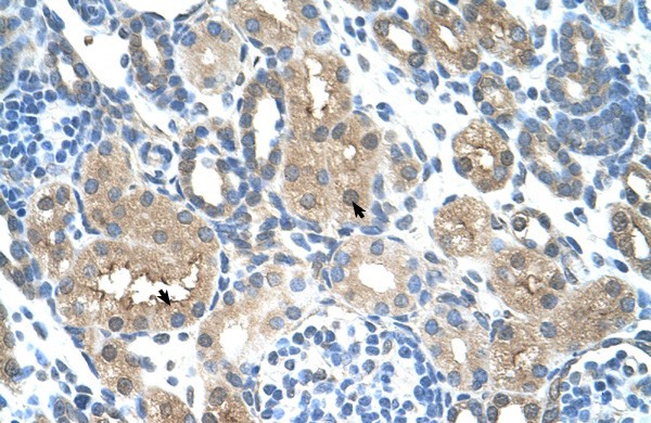 TLR6 antibody - middle region