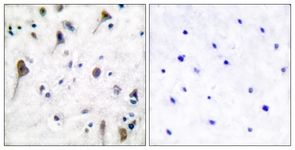 PYK2 (Phospho-Tyr580) antibody