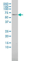 MAP3K7IP1 Antibody (monoclonal) (M01)