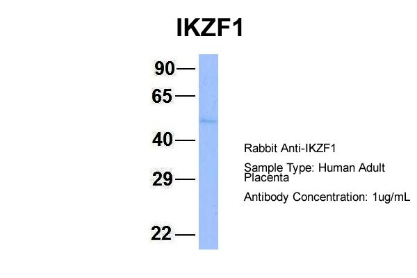 IKZF1 antibody