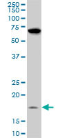 NDUFB11 Antibody (monoclonal) (M08)