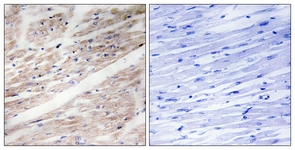 KIT (Phospho-Tyr936) antibody