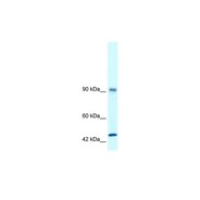 RBM10 antibody