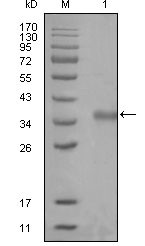 NCOR1 Antibody