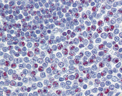 FOXM1 antibody - N-terminal region
