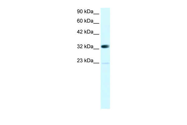 CBX4 antibody - N-terminal region