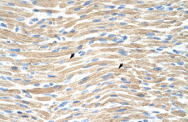 LMX1A antibody - middle region