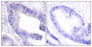 IRS-1 (Phospho-Ser1101) antibody