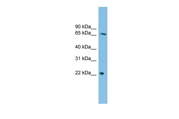 DYRK3 antibody