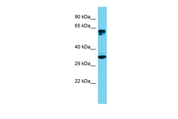 ATF5 Antibody