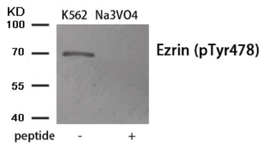 Ezrin (phospho Tyr478) Antibody