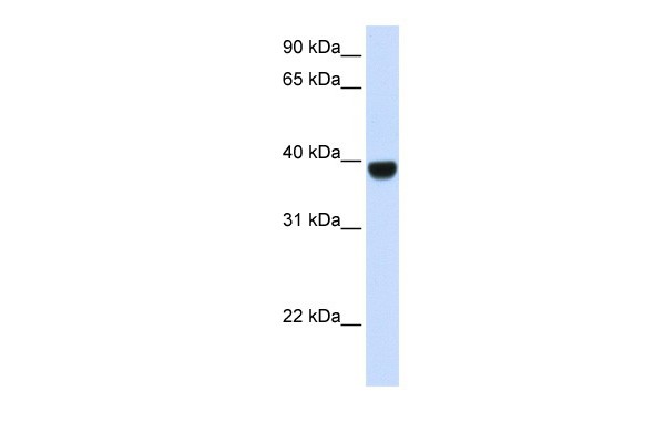 FOXE1 antibody - middle region