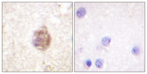 IRS-1 (Phospho-Ser794) antibody