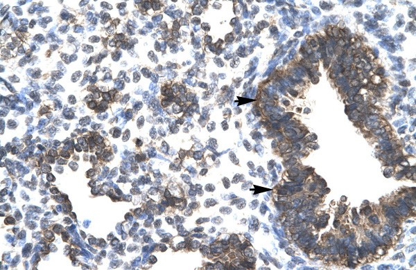ESRRG  antibody - middle region