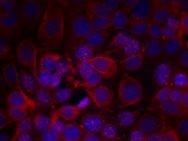 HER2 (phospho Tyr1221 / Tyr1222) Antibody