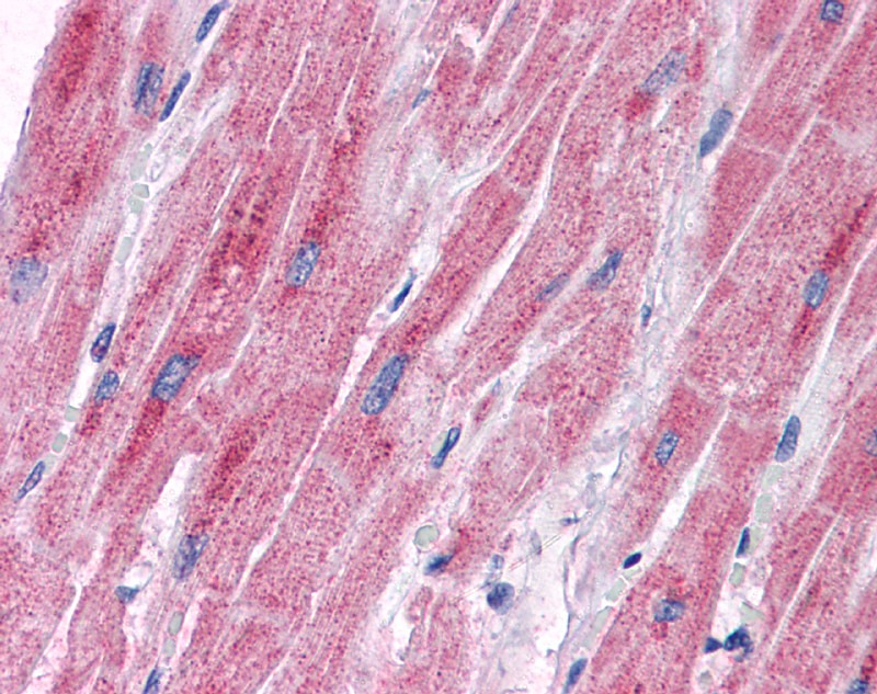 PDK2 antibody