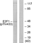 E2F1 (Phospho-Thr433) antibody