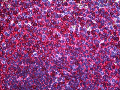 PTPRC Antibody