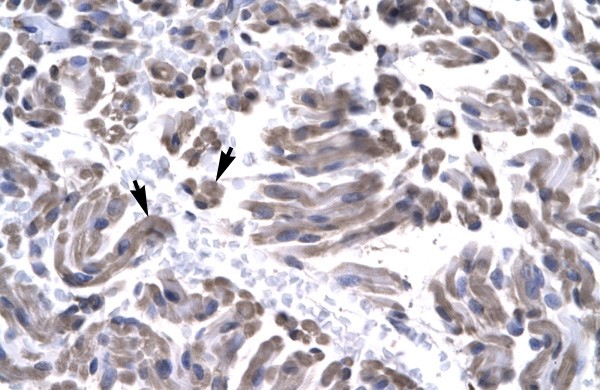 GTF2H3 antibody