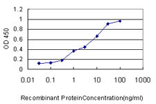 LSM3 Antibody (monoclonal) (M01)