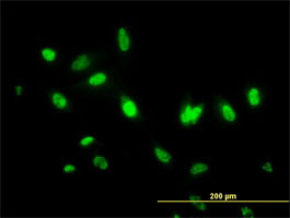 MDS028 Antibody (monoclonal) (M06)