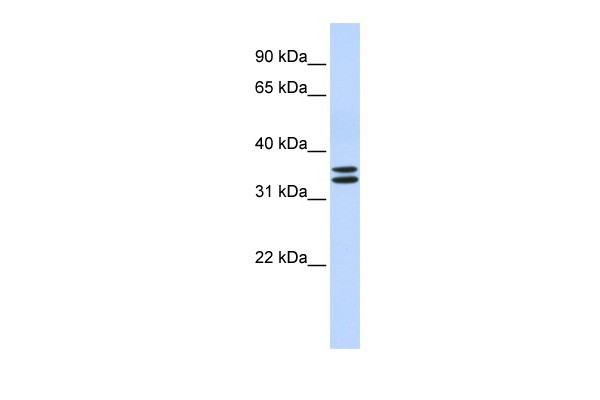 TAL1 antibody - N-terminal region