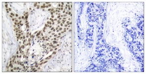 Androgen Receptor (Phospho-Ser213) antibody
