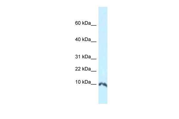 Sumo1 antibody